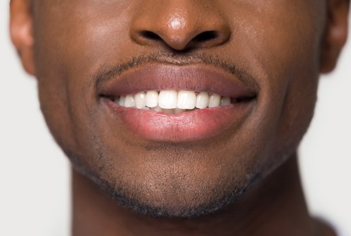 Closeup of man with dental bonding in McMinnville