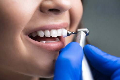 Teeth being polished