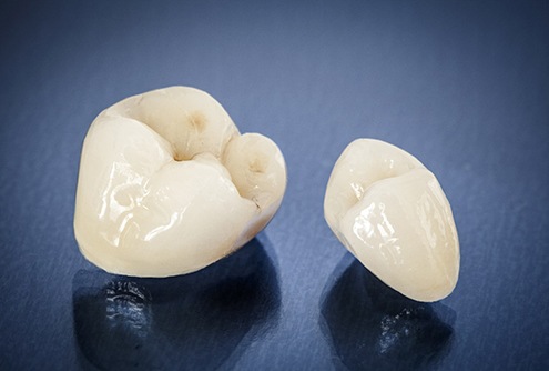 Two dental crowns in McMinnvile sitting on tabletop