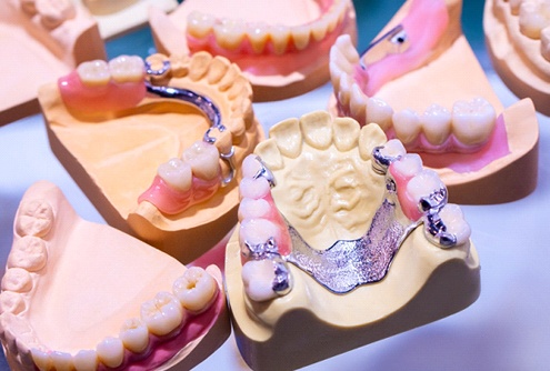 4 sets of dentures on a table
