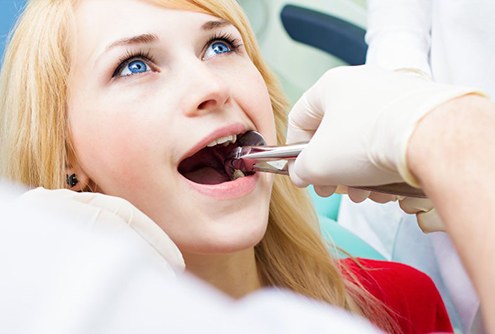 young woman getting a tooth extracted 