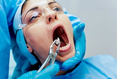 emergency dentist performing tooth extraction in McMinnville