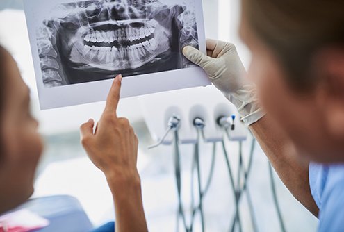 Patient and dentist discussing advanced dental implant procedures in McMinnville