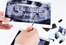 Implant dentist holds X-rays before bone grafting in McMinnville