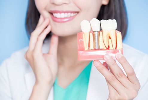 McMinnville implant dentist holding model of dental implants