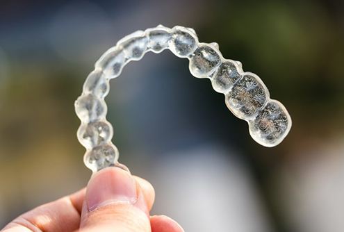 Closeup of Invisalign in McMinnville