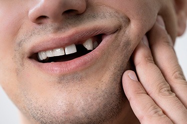 Patient in St. Joseph smiling with missing tooth
