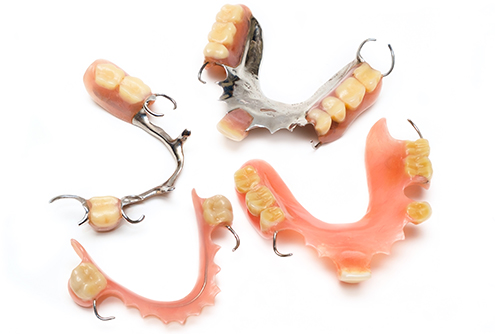 Four types of dentures