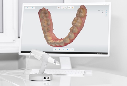 a digital impression of teeth