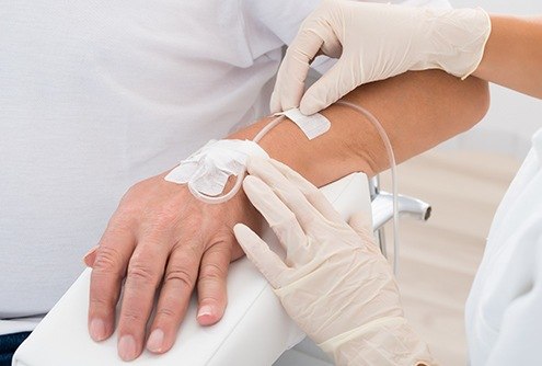 Hand with IV needle in place