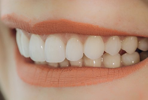 Closeup of woman smiling with veneers in McMinnville