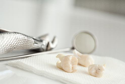 Dental tools lying next to prop teeth on gauze