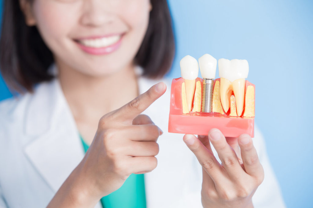 dentist smiling and holding a dental implant