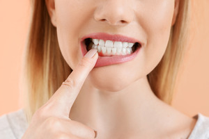 Woman pulling down lip to show inflamed gums