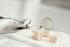 Extracted teeth on a tray next to dental instruments